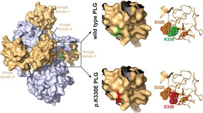 Mutant plasminogen in hereditary angioedema is bypassing FXII/kallikrein to generate bradykinin